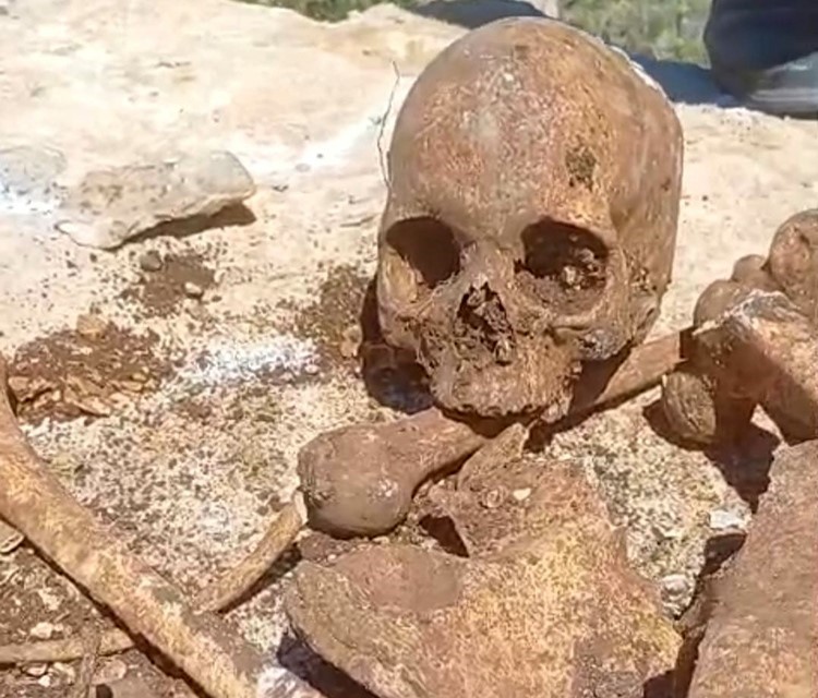 Malatya’da temel hafriyatında insan kemikleri bulundu