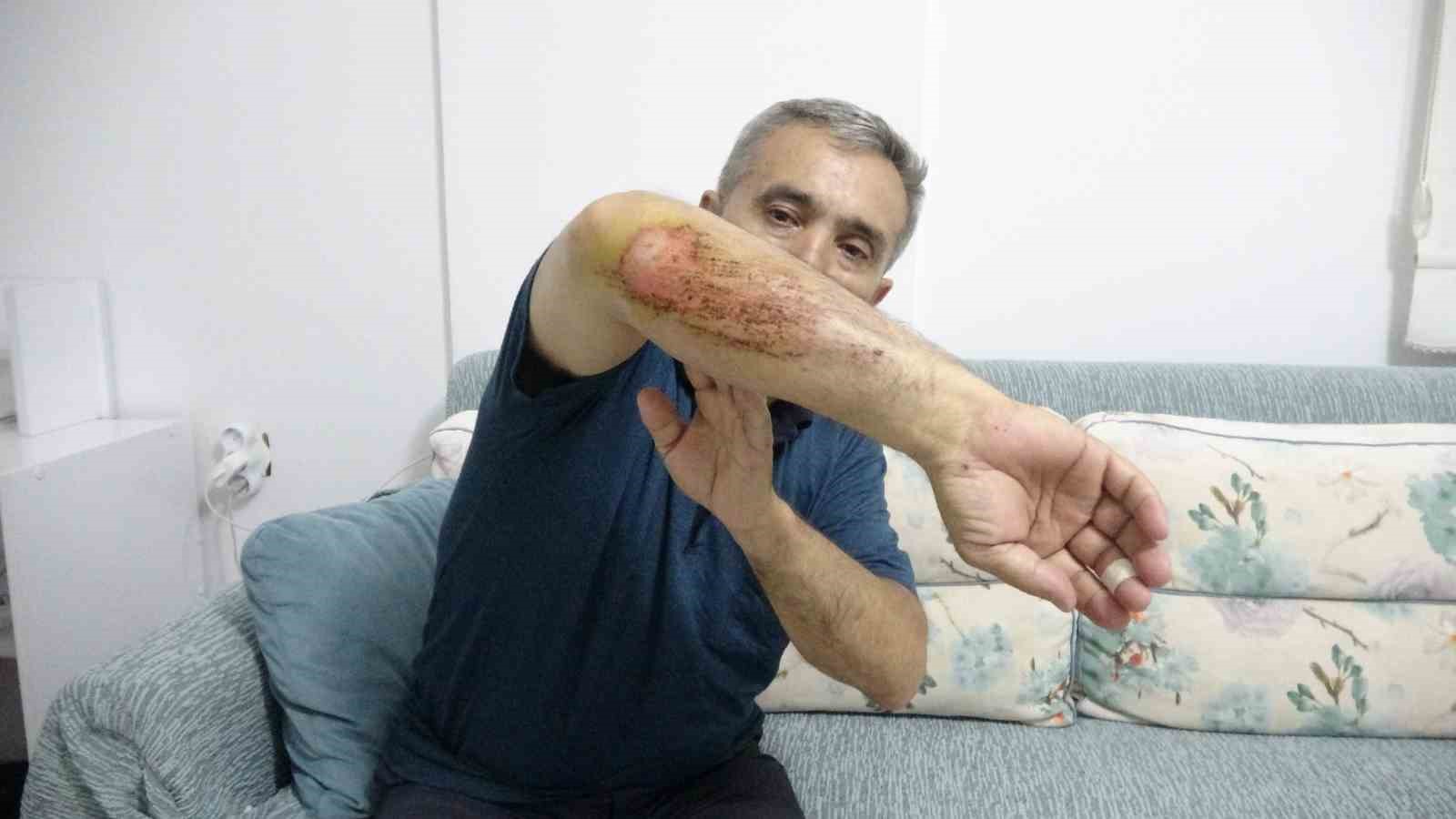 Otizmli oğluyla tabiat gezisi sırasında sahipli köpeklerin saldırısına uğradı
