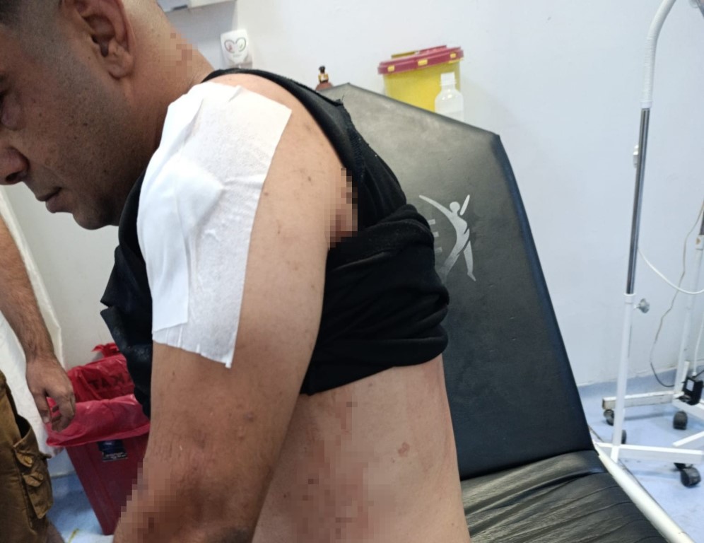 İş Görüşmesi Sırasında Yaşanan Korkunç Saldırı ve Genç Adamın Hayatta Kalma Hikayesi
