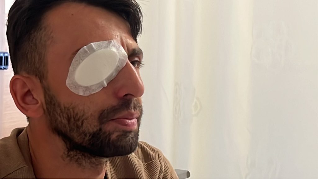 Hayatını Kaybeden Göz ve Yaşadıkları